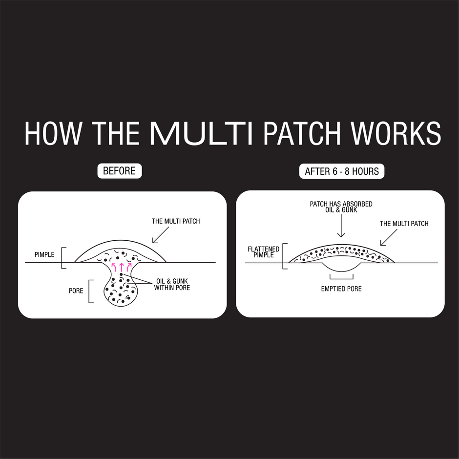 HOW TO USE THE MULTI PATCH